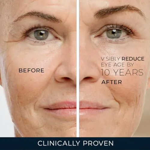 RoC Retinol Correxion Under Eye Cream Review image 5