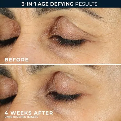 RoC Retinol Correxion Under Eye Cream Review image 6