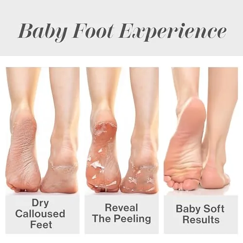 Baby Foot Original Exfoliation Foot Peel Review image 4