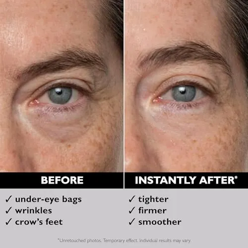 Peter Thomas Roth Instant FIRMx Eye Tightener Review image 5