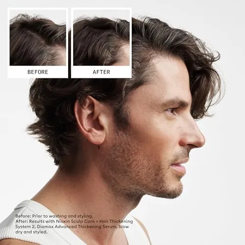 Nioxin System 2 Shampoo Review: Thinning Hair Care image 2