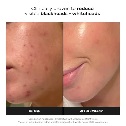 Paula's Choice 2% BHA Liquid Exfoliant Review image 2