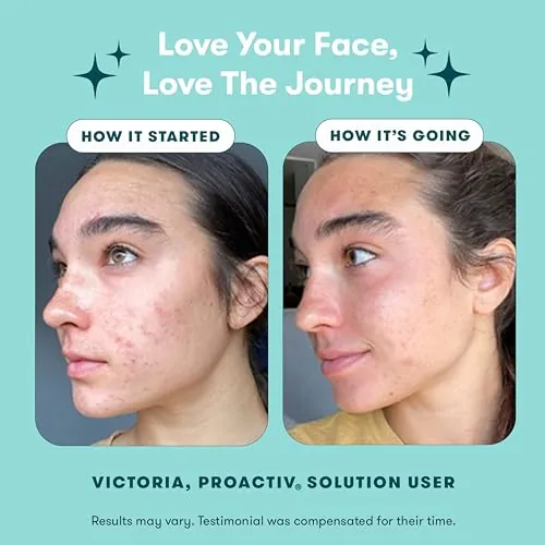 Proactiv 3 Step Acne Treatment Kit Review image 3