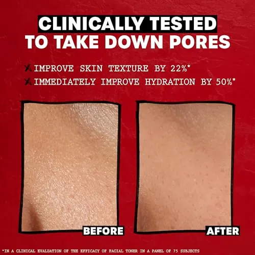 THAYERS Rose Petal Witch Hazel Toner Review image 5