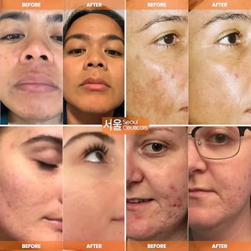 SeoulCeuticals Vitamin C Serum Review: Hyaluronic Acid Serum image 3