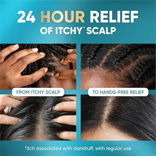 Head & Shoulders Royal Oils Scalp Elixir Review image 4