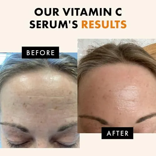 Eclat Skincare Vitamin C Serum Review: Brightening Face Serum image 4