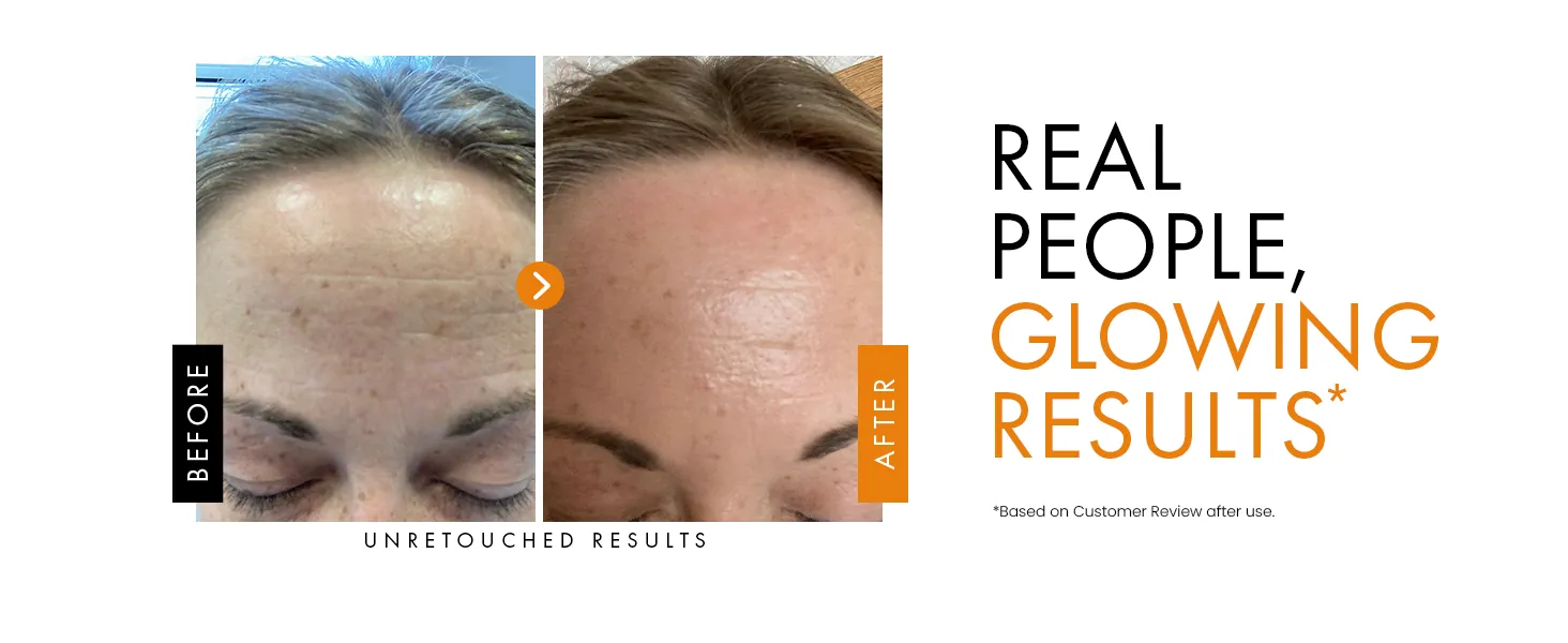 Eclat Skincare Vitamin C Serum Review: Brightening Face Serum image 9