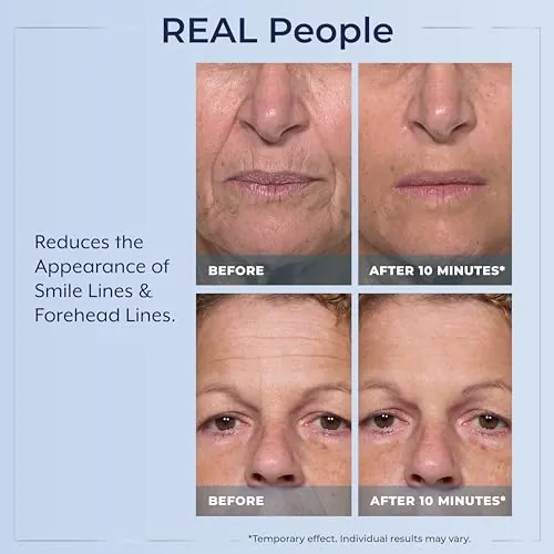 Plexaderm Rapid Reduction Eye Serum Review image 4
