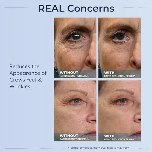 Plexaderm Rapid Reduction Eye Serum Review image 5