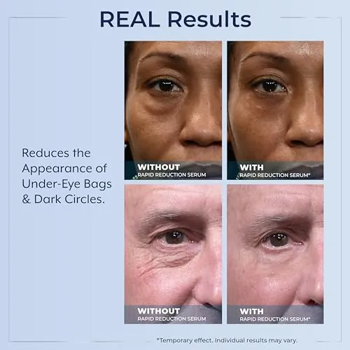 Plexaderm Rapid Reduction Eye Serum Review image 6