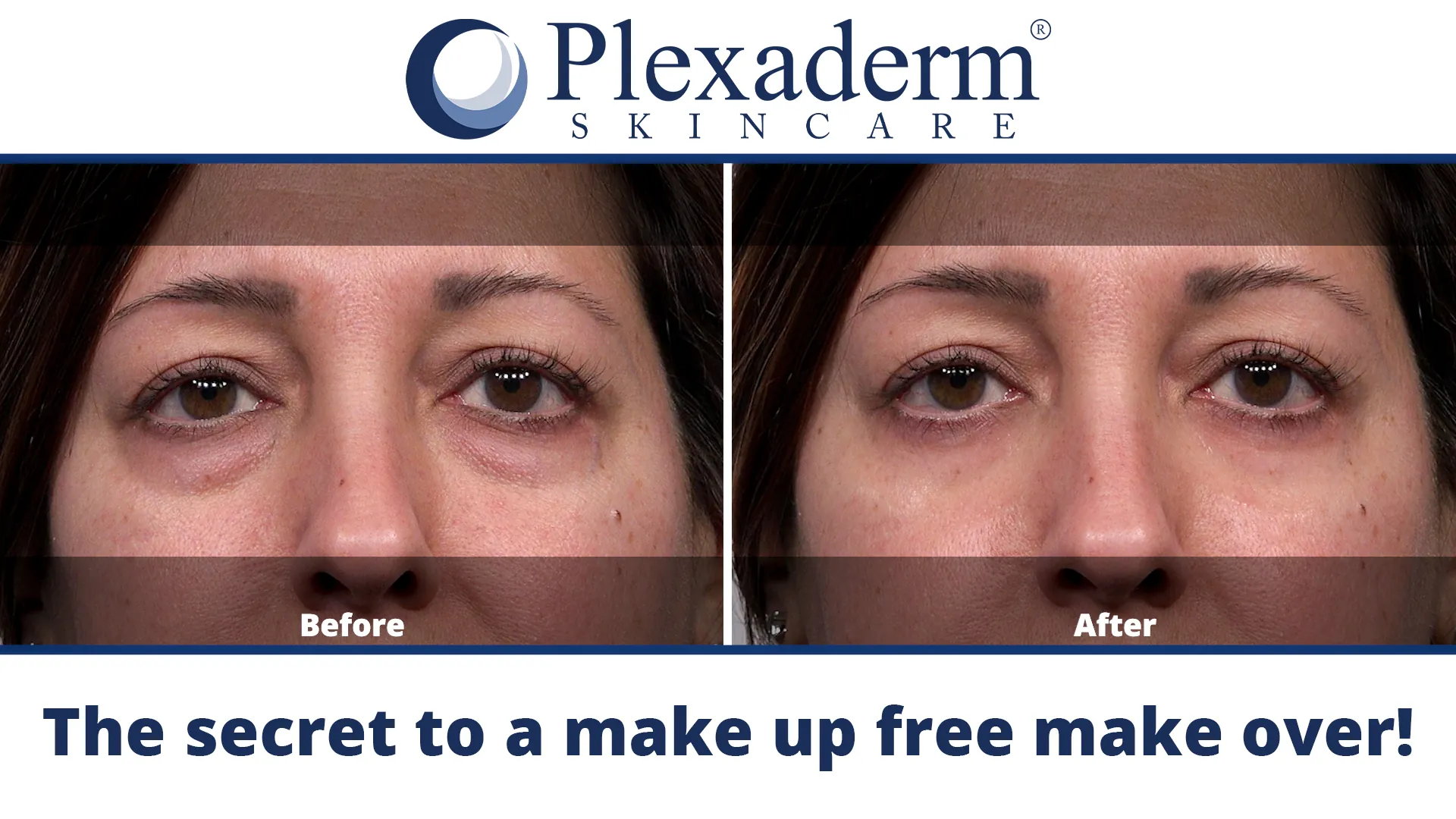 Plexaderm Rapid Reduction Eye Serum Review image 7