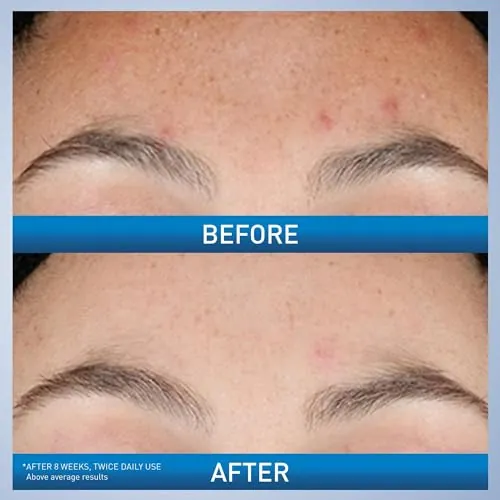 CeraVe Resurfacing Retinol Serum Review image 3