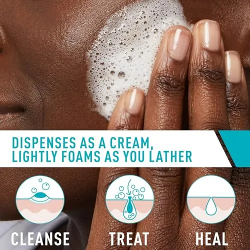 CeraVe Acne Foaming Cream Cleanser Review: 4% BPO Wash image 3