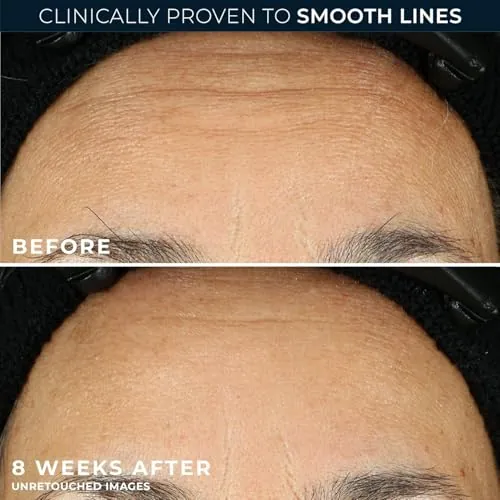 RoC Retinol Correxion Night Serum Capsules Review image 4