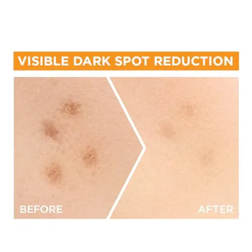 Garnier Bright Complete Vitamin C Serum Review image 5