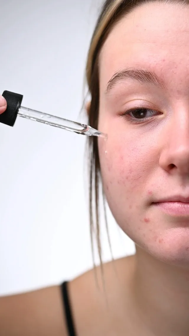 Minimalist Salicylic Acid 2% Face Serum Review image 7