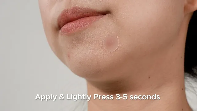 TKTK Pimple Patch Review: Hydrocolloid Acne Patches image 7