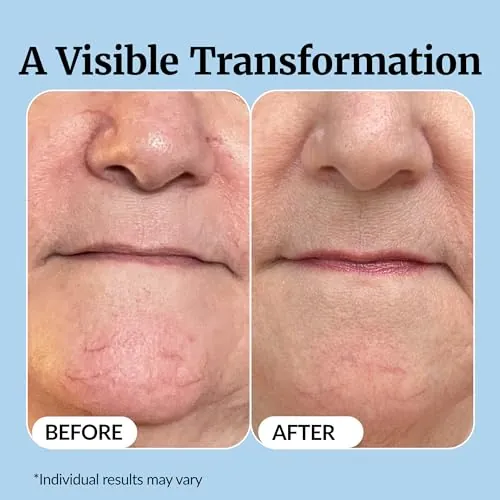 Vibriance Super C Serum Review: Vitamin C for Mature Skin image 5