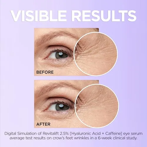 L'Oreal Revitalift Eye Serum Review: Hyaluronic + Caffeine image 6