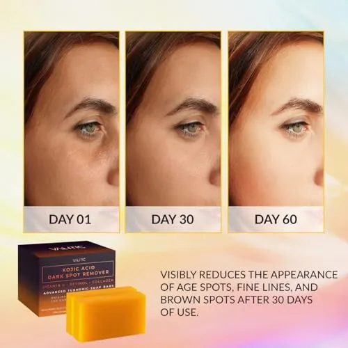 VALITIC Kojic Acid Soap Review: Dark Spot Remover Bar image 2