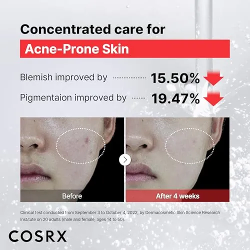 COSRX 15% Niacinamide Face Serum Review image 4