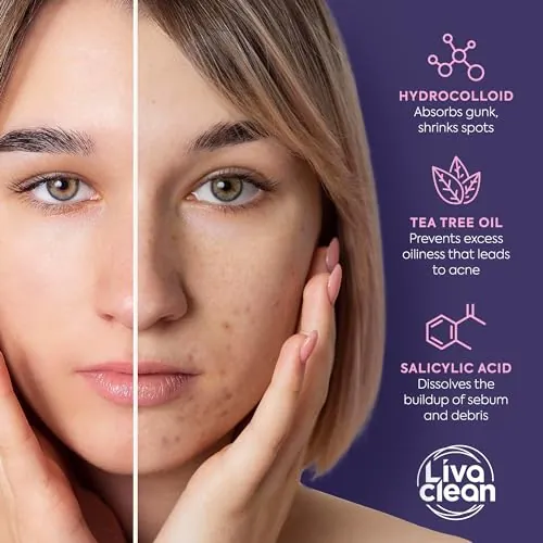 Livaclean 240CT Star Pimple Patches Review image 6