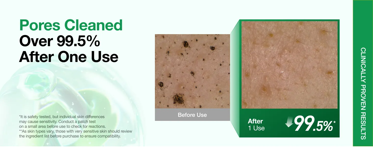 Anua Heartleaf Pore Deep Cleansing Foam Review image 9