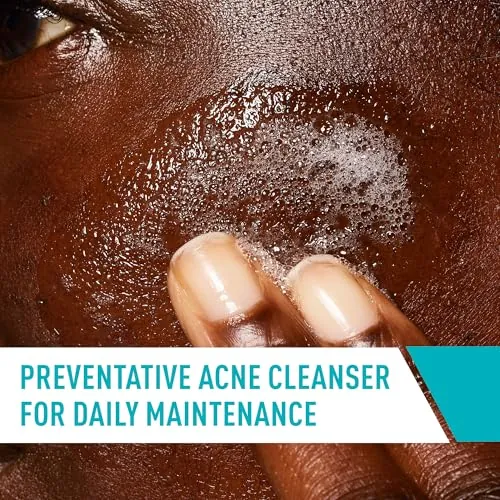 CeraVe Acne Control Cleanser Review: 2% Salicylic Acid image 4