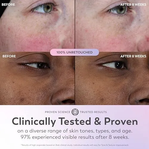 Olay Super Serum Review: Glow Face Serum image 6