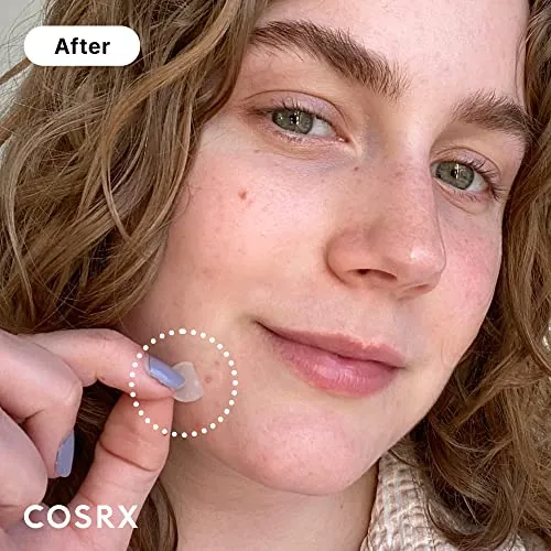 COSRX Acne Pimple Patch Review: Hydrocolloid Spot Patches image 3
