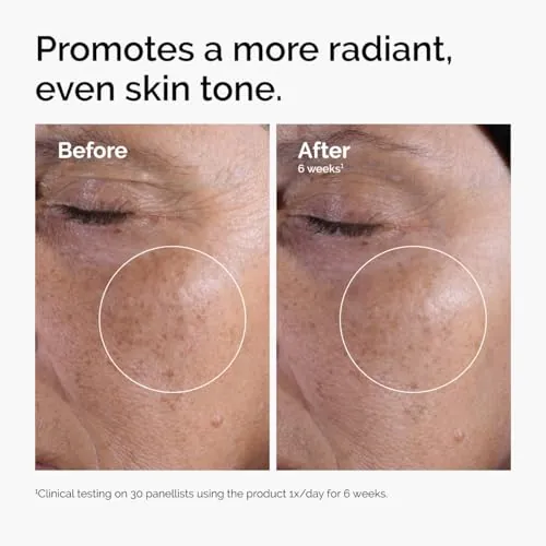 The Ordinary Glycolic Acid 7% Toner Review image 2