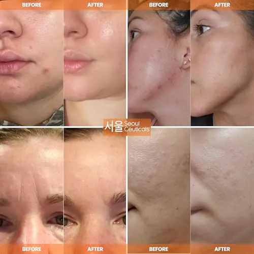 SeoulCeuticals Snail Mucin Moisturizer Cream Review image 3