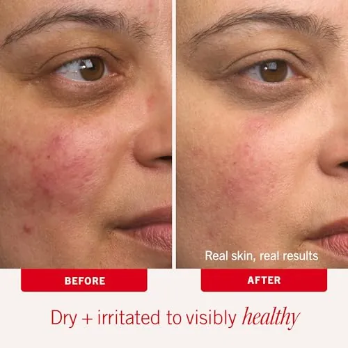First Aid Beauty Ultra Repair Cream Moisturizer Review image 4